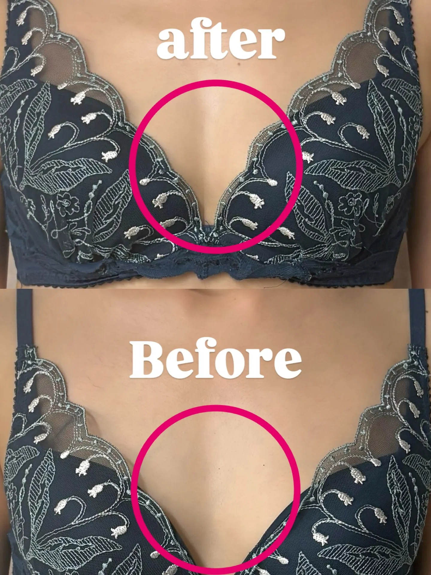 バストUP施術2回目🌿