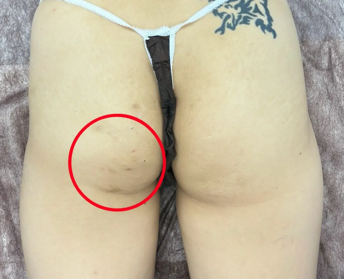 横に広がりやすいヒップラインが、