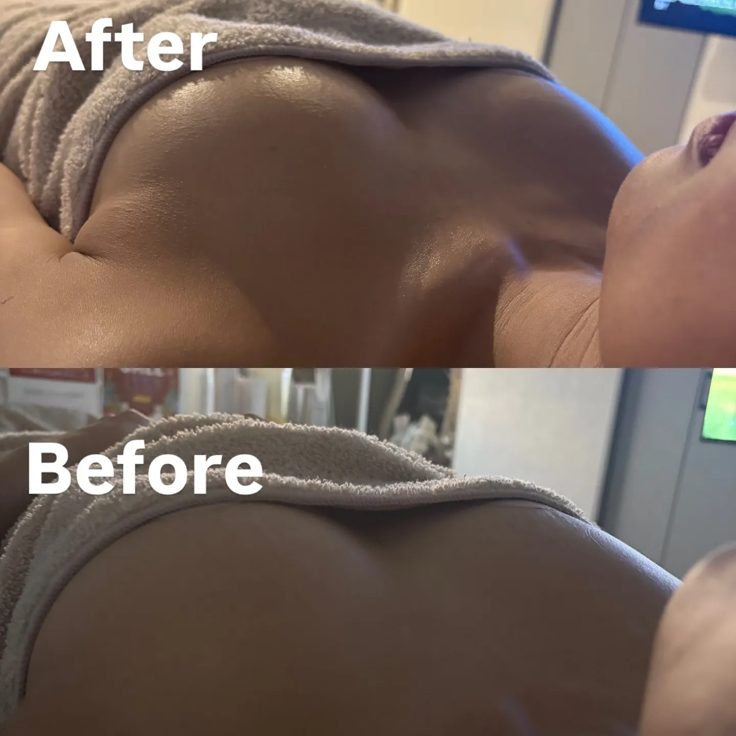 バストアップ施術直後の写真✨