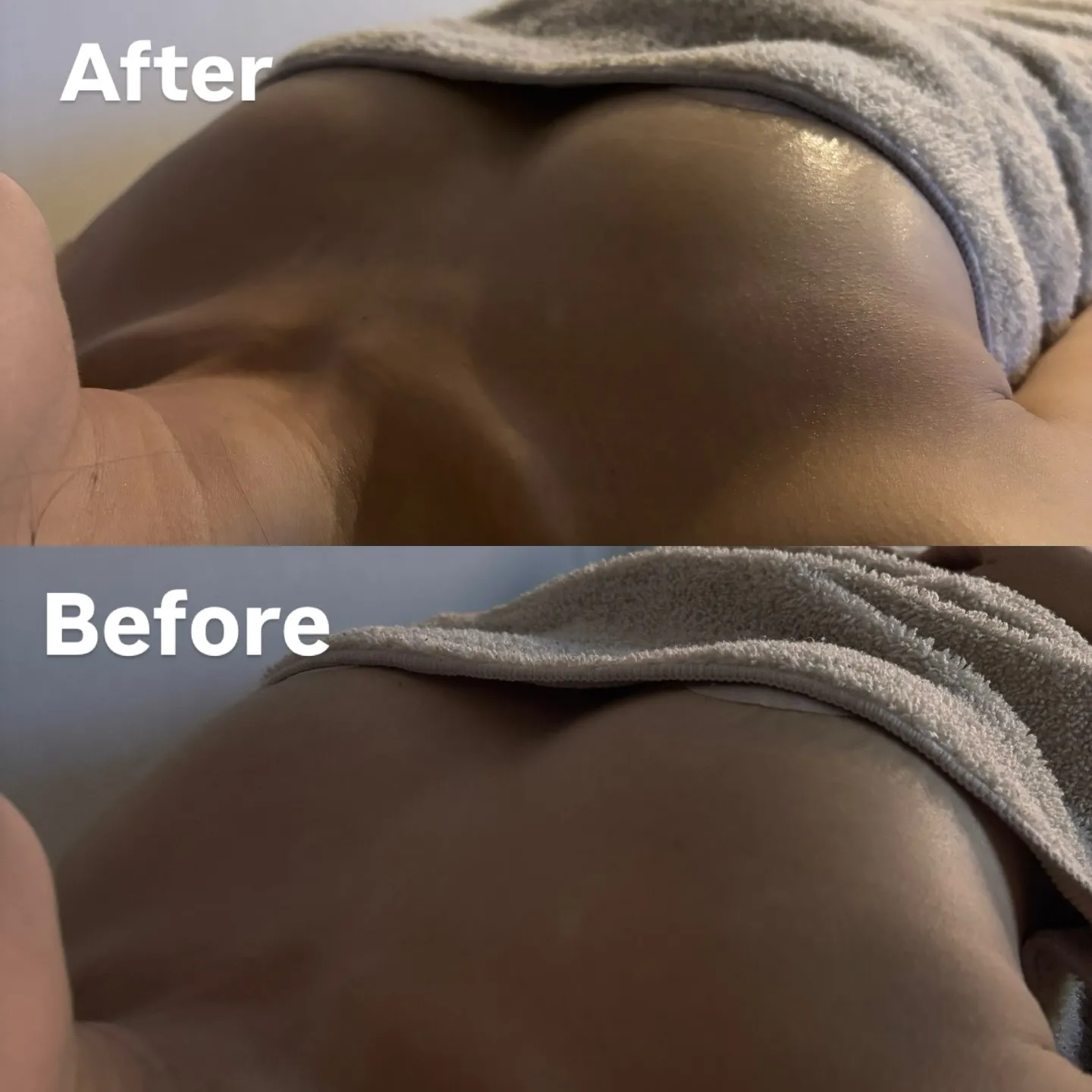 バストアップ施術直後の写真✨